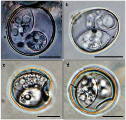 Isospora! A Microscopic Marvel Living within Another Creature's Guts