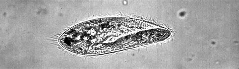  Udallia: Can It Really Swim Backwards With Its Cilia?